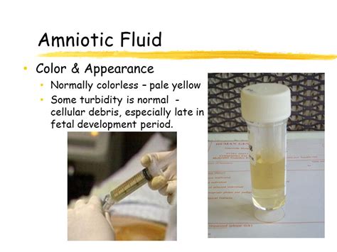 straw colored amniotic fluid|Amniotic Fluid: Color, Smell, Function & Disorders